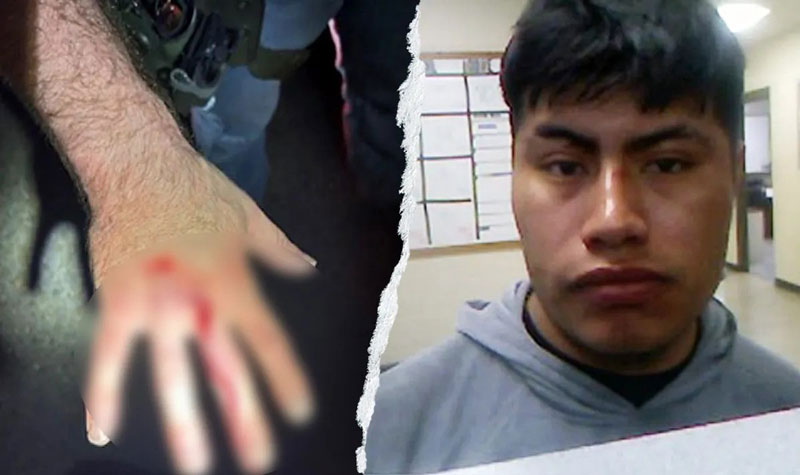 ICE officer injured after bitten by an illegal immigrant in U.S