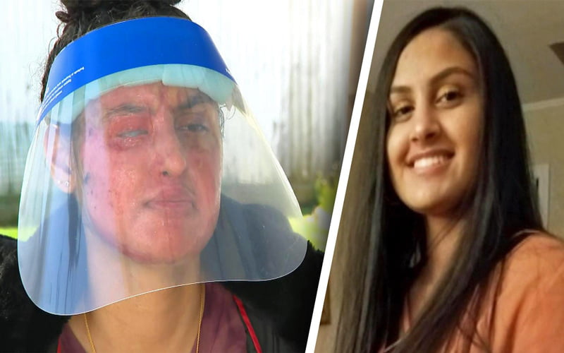 Acid attack on Muslim women in US this time