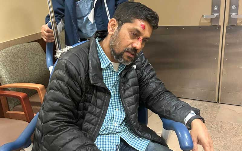 Bangladeshi photojournalist injured by miscreant attack in New York