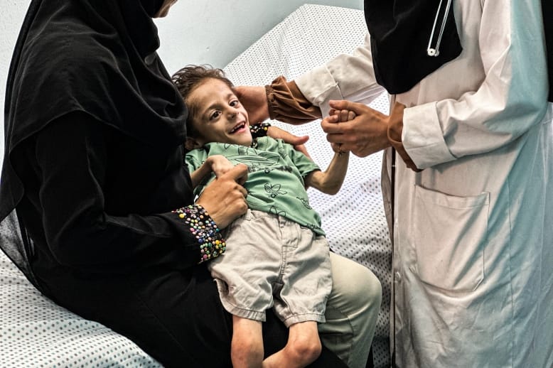 Every child under five in Gaza face malnourishment: UN