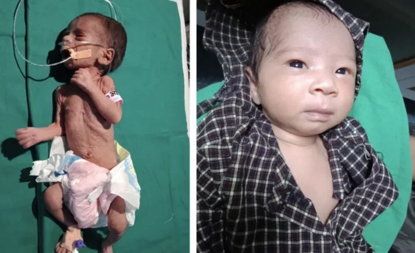 Newborn baby buried alive in India fights for her life