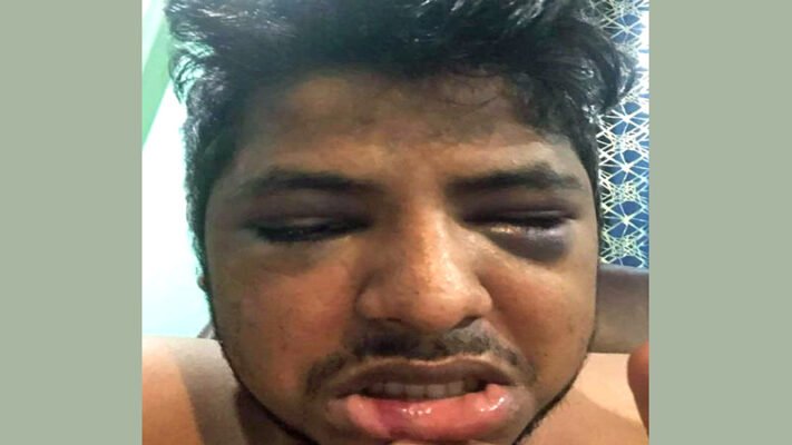 Bangladeshi comes under fresh attack in New York