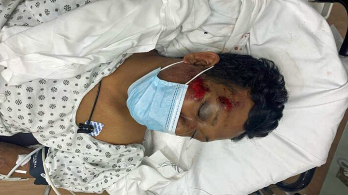 Bangladeshi man seriously injured in attack by black miscreants in New York