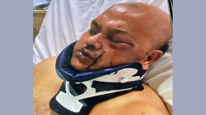 Terrorist attack on Bangladeshi councilman in New Jersey: Panic among expatriates