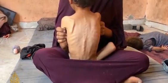 Israel starves Gaza as global condemnation grows