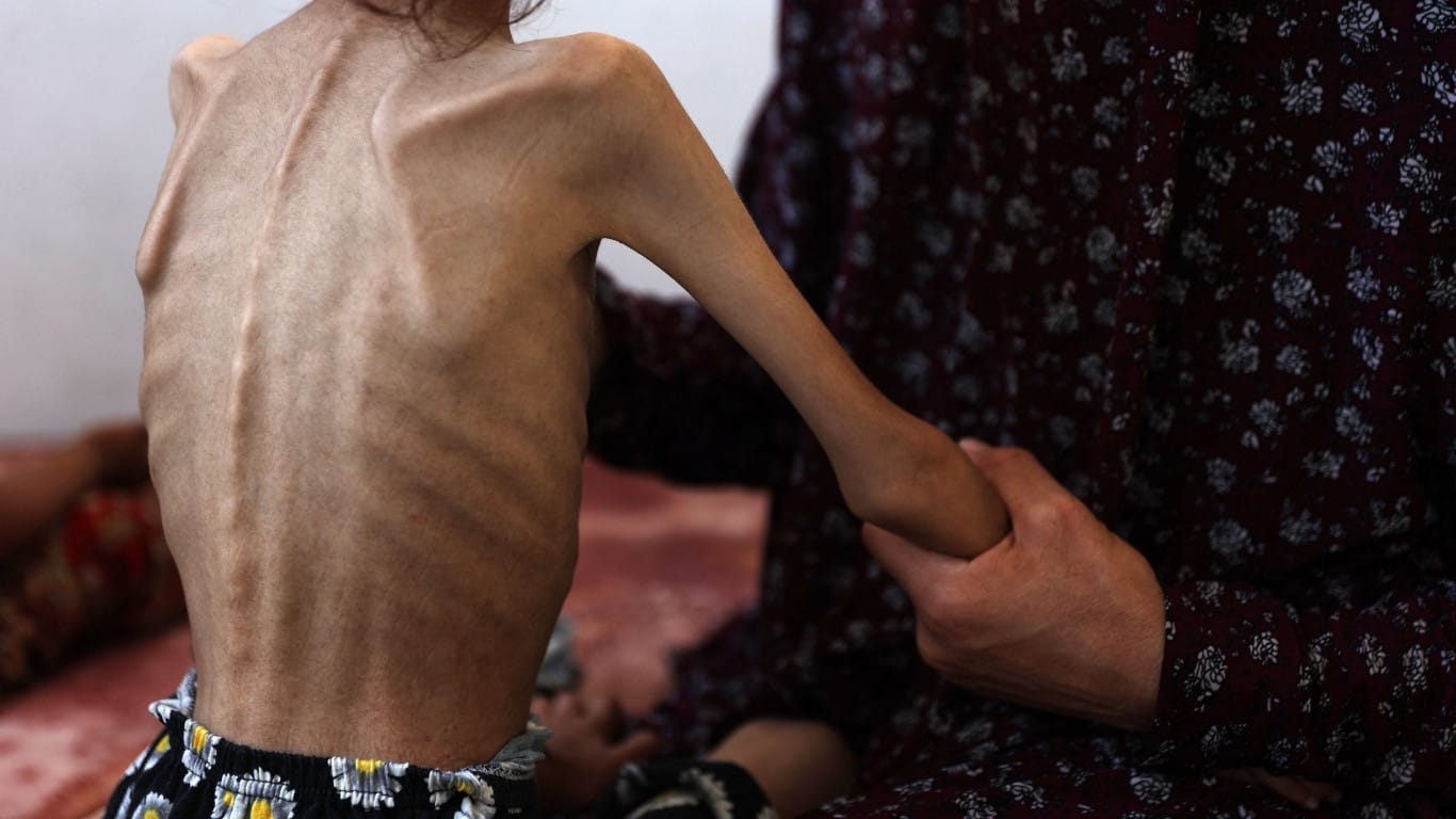 Famine kills nearly 200 in Gaza